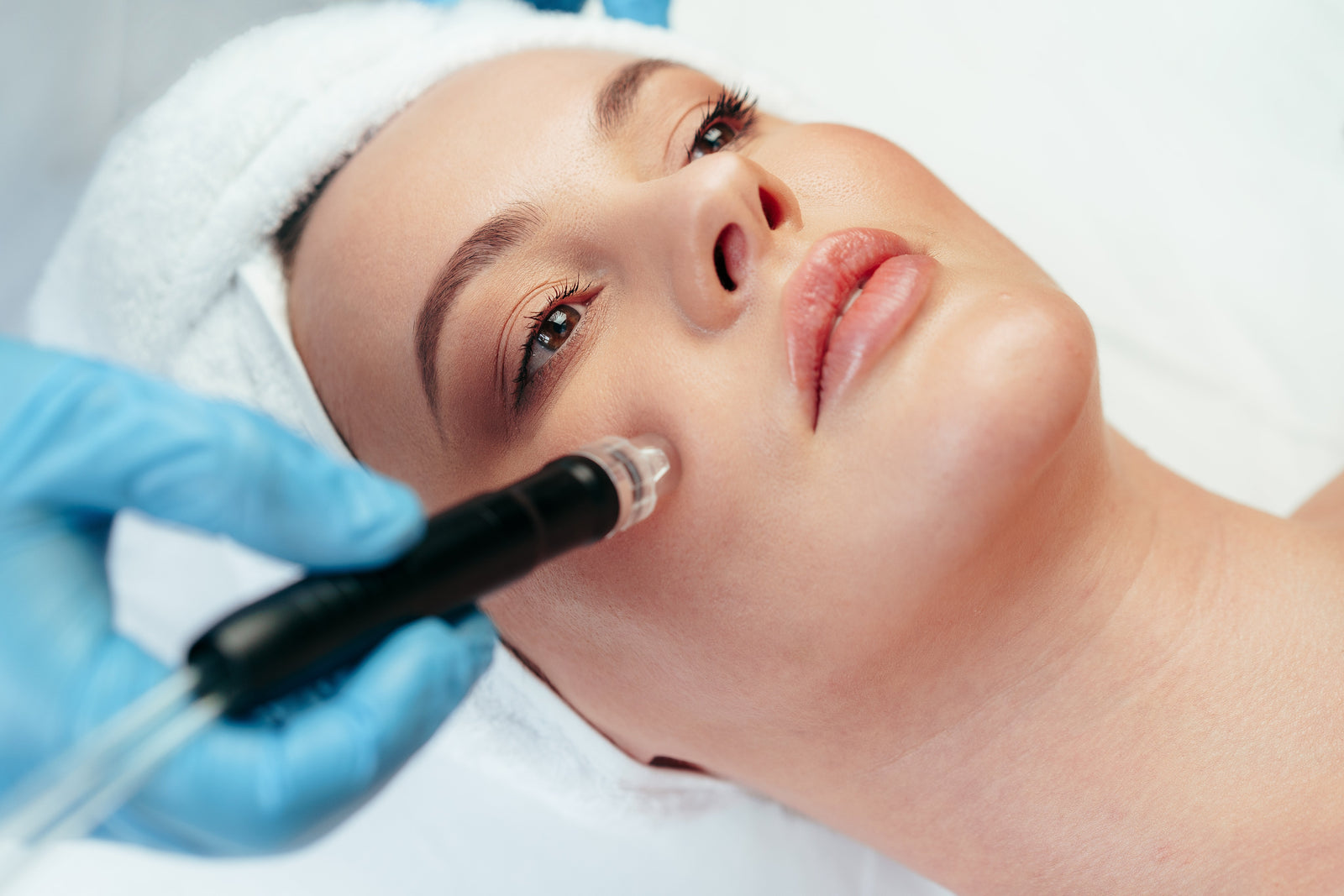 Microneedling