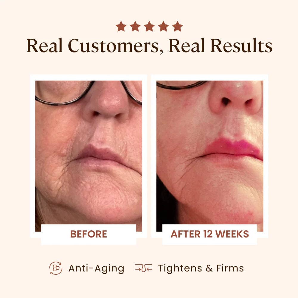 Skin Skulpt Plasma Skin Perfector