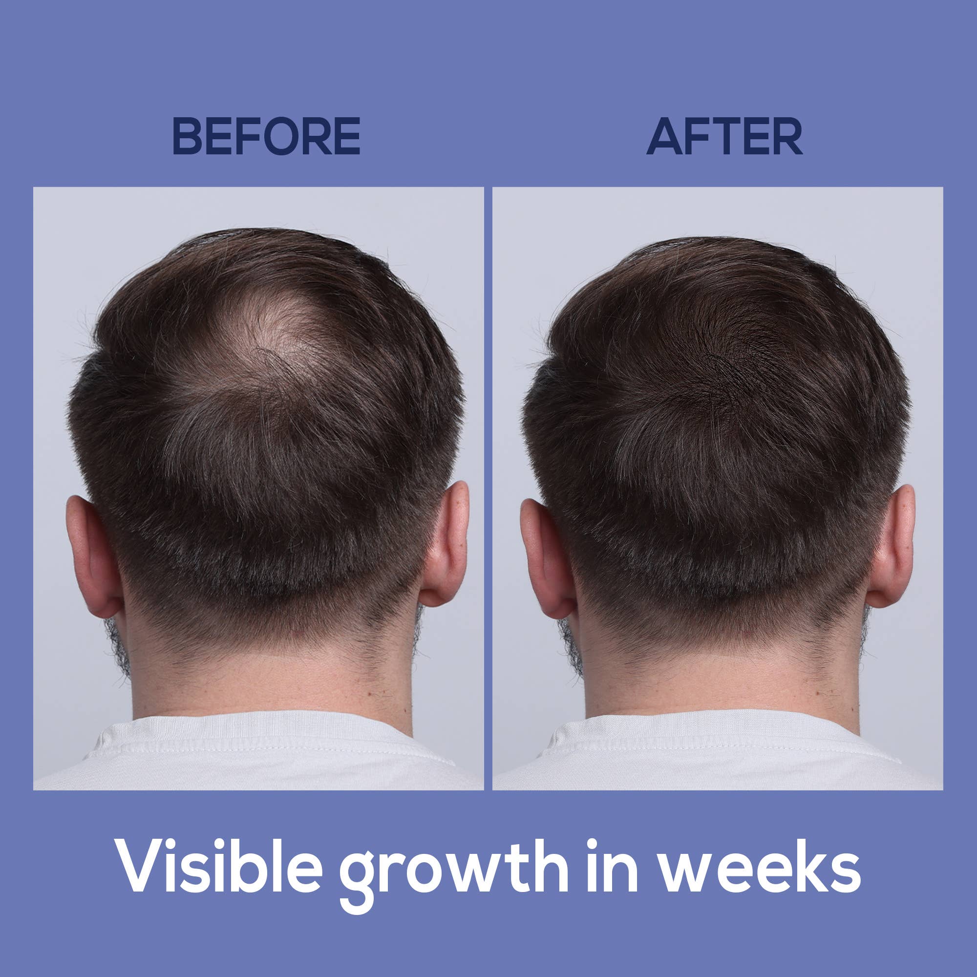 Harmonify Black Rice Water Spray — Korean Fermented Hair Growth Serum