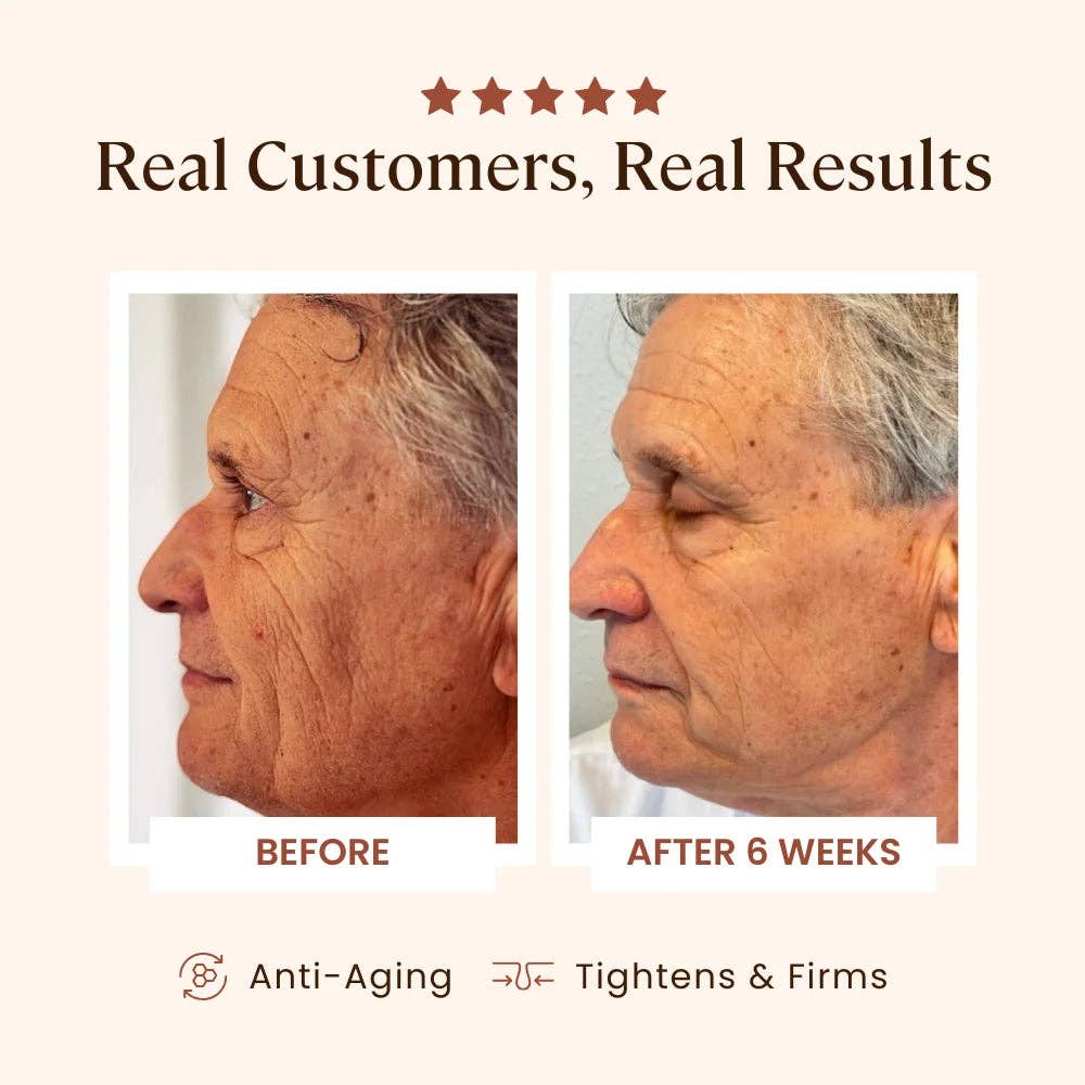 Skin Skulpt Plasma Skin Perfector