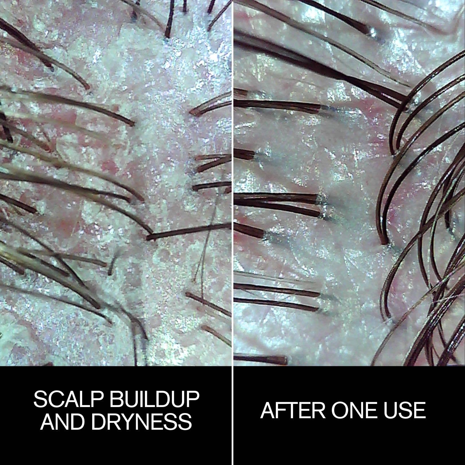Najeau Follicle Drops Pre-Shampoo Scalp Oil