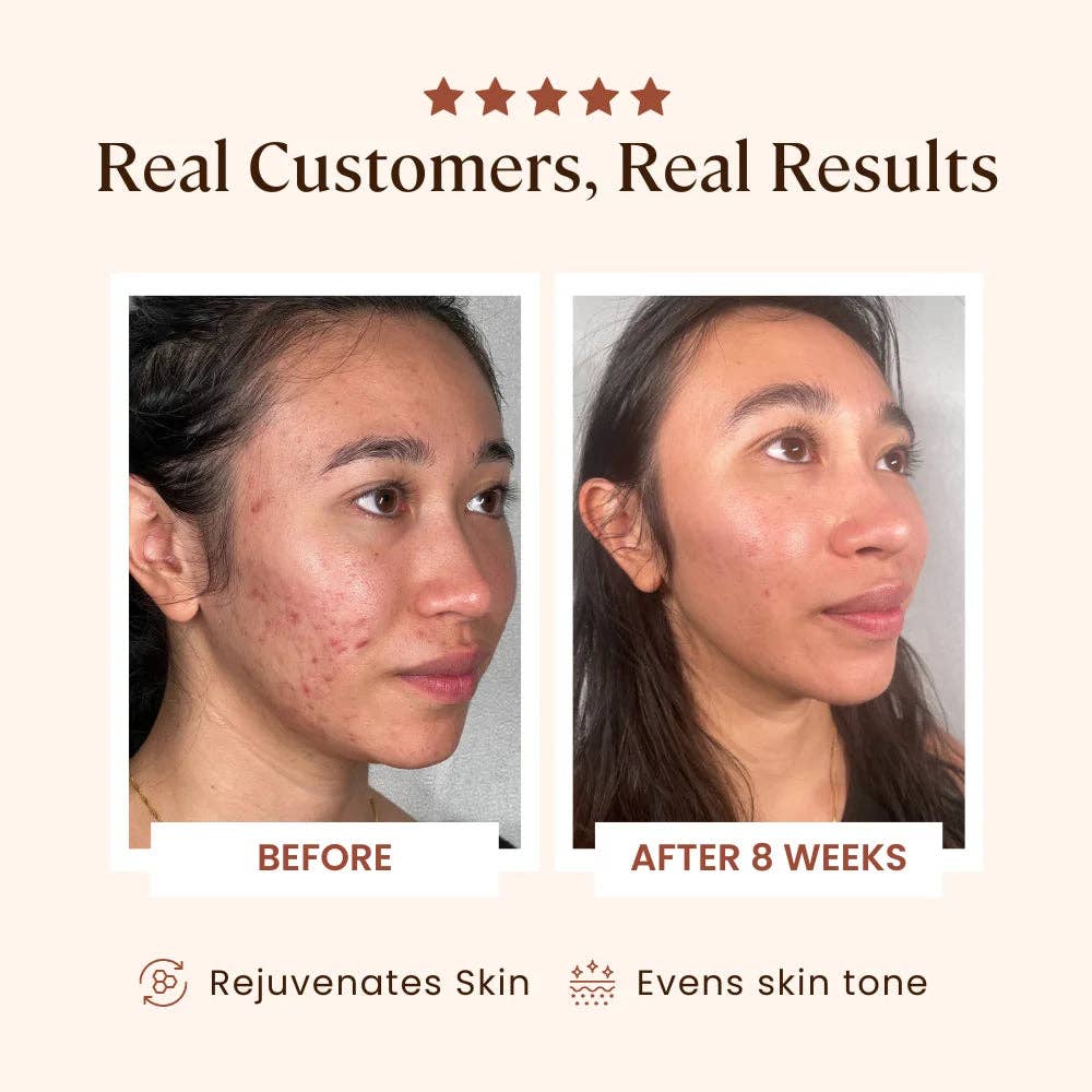 Skin Skulpt Plasma Skin Perfector