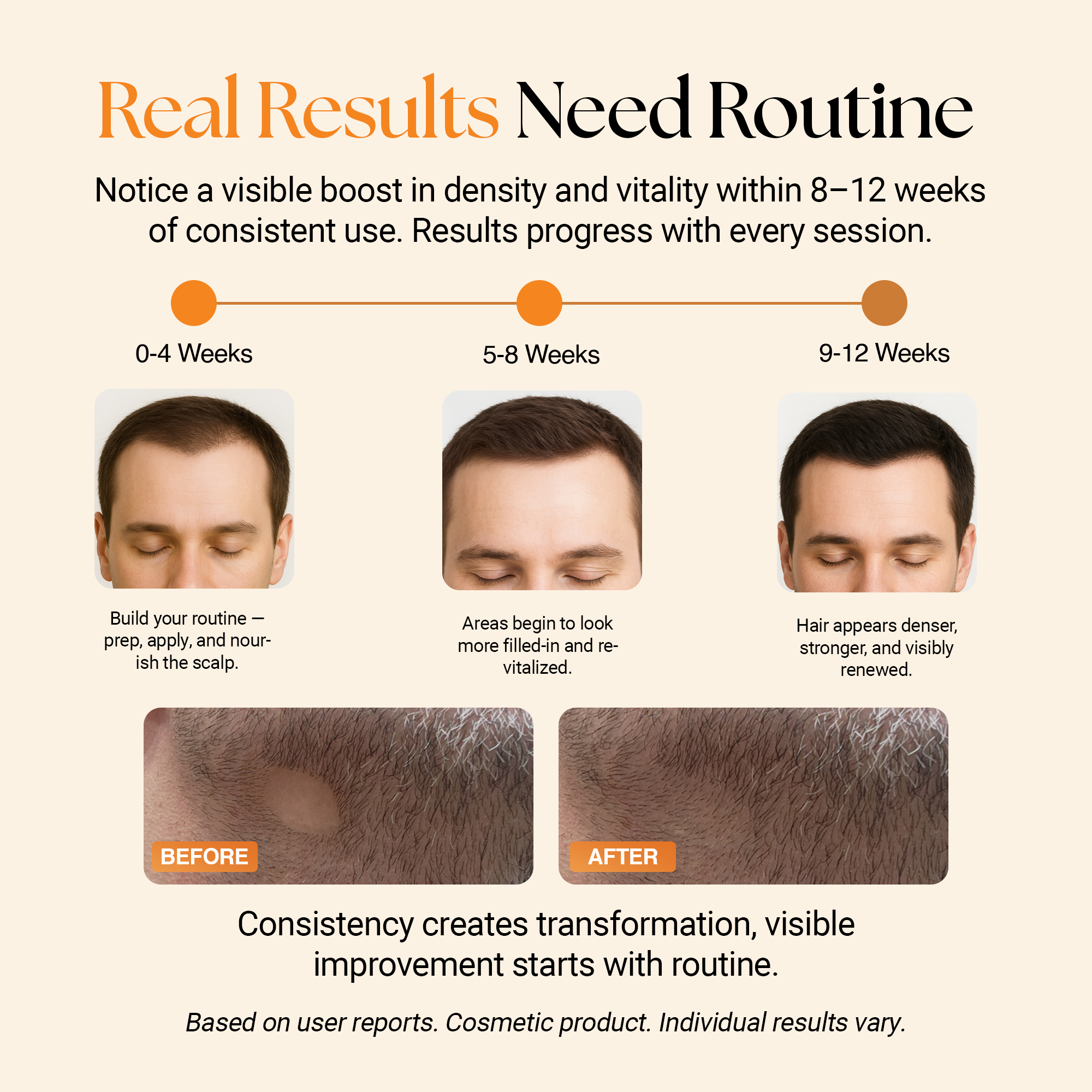 ReGlow Hair Micro‑Infusion System – At‑Home Hair Density Enhancer