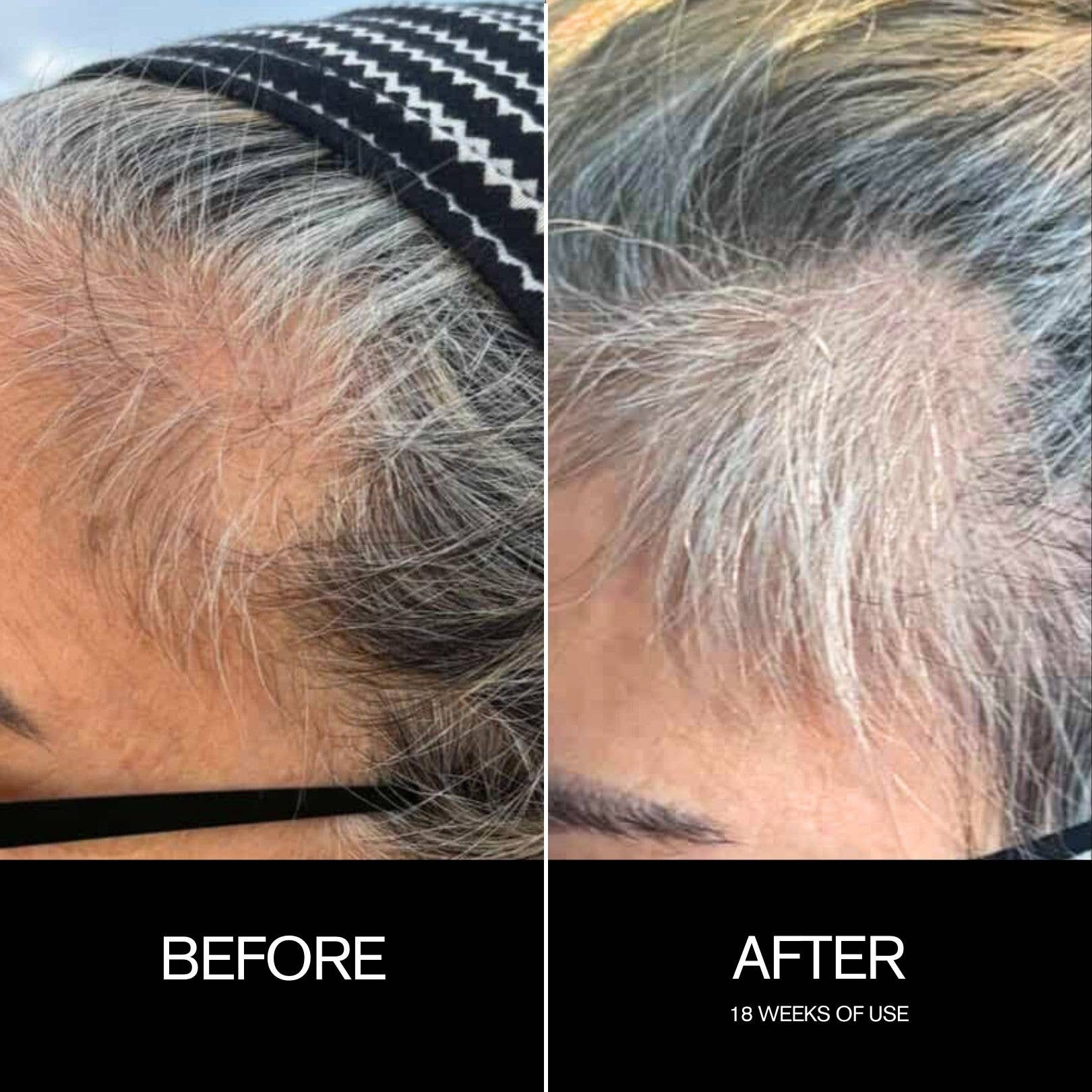 Najeau Copper Sequence – Leave‑In Scalp Treatment for Fuller Hair