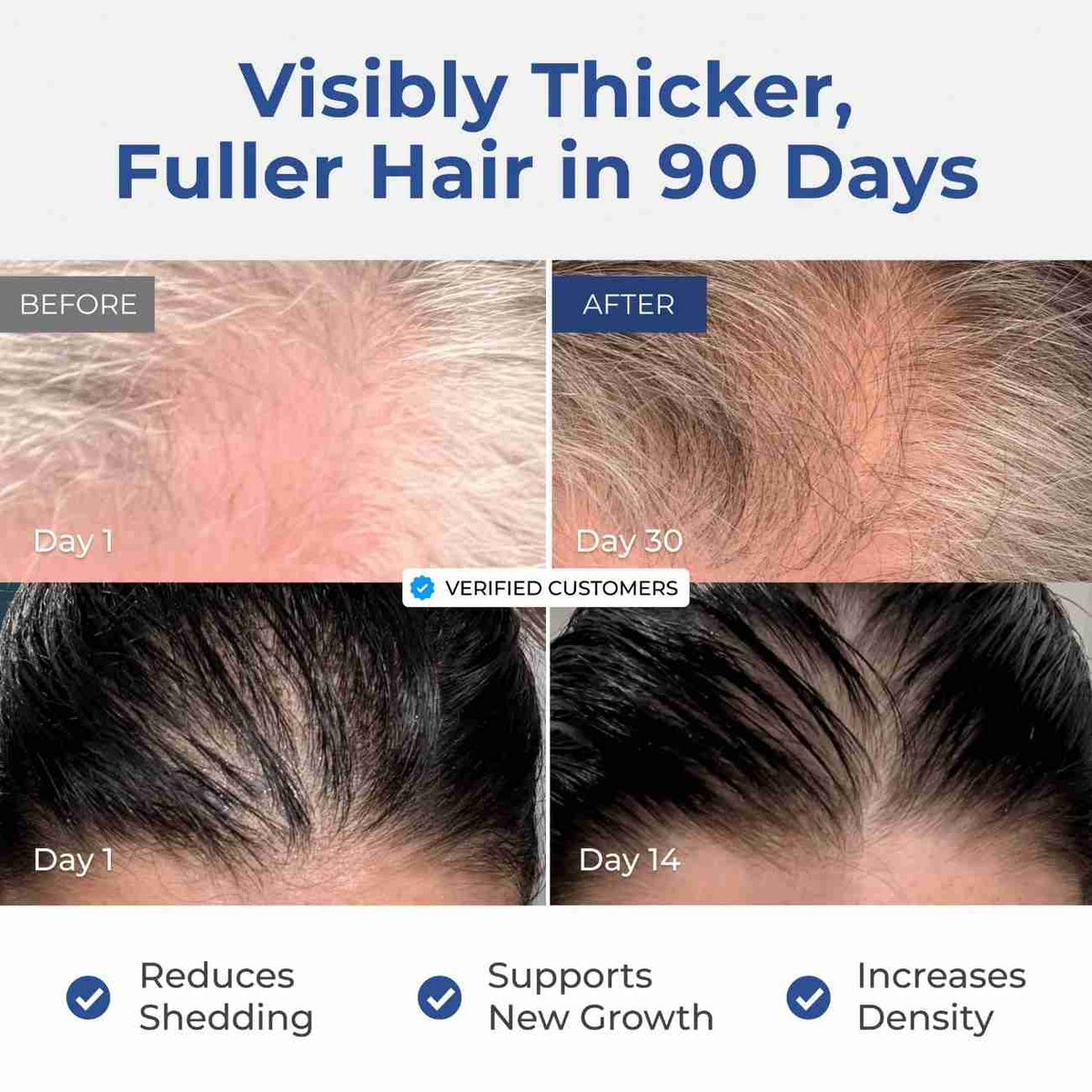 Infographic with scalp photos for a copper peptide hair serum