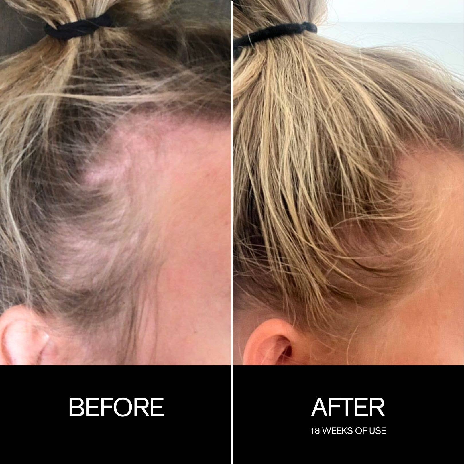 Najeau Follicle Drops Pre-Shampoo Scalp Oil