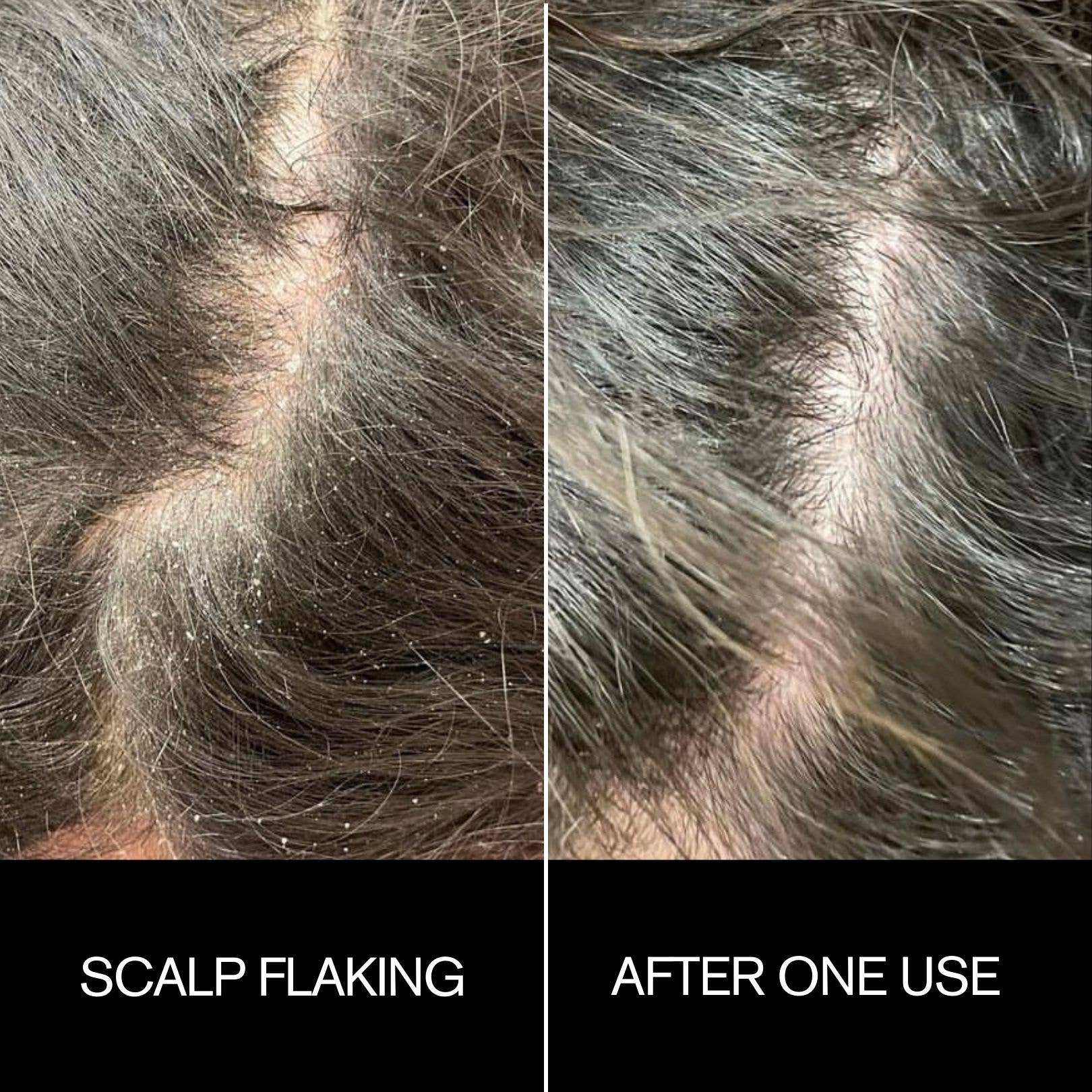 Najeau Scalp Mask